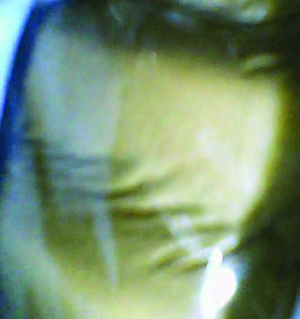 第二个挤压玩具样本