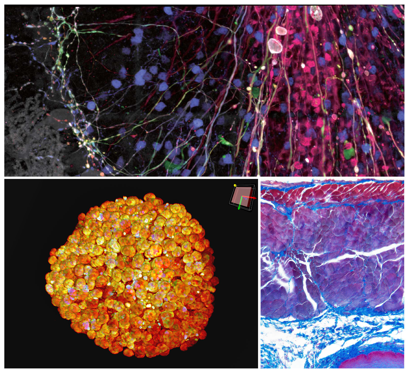 Top: Image of Brainbow AAV transfection of Purkinje cells, amplified with antibodies Purkinje cell somata, dendrites, and axons are visible, as well as some aspecific stainings of granule cells acquired by the FV3000 microscope Bottom left: Cleared spheroid of HT-29 cells stained with DAPI (nuclear) acquired by the Evident IXplore Spin system Bottom right: Azan stained captured by the DP74 digital microscope camera