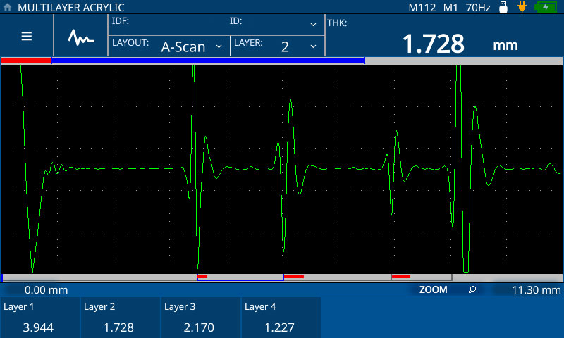 A扫描:超声A扫描