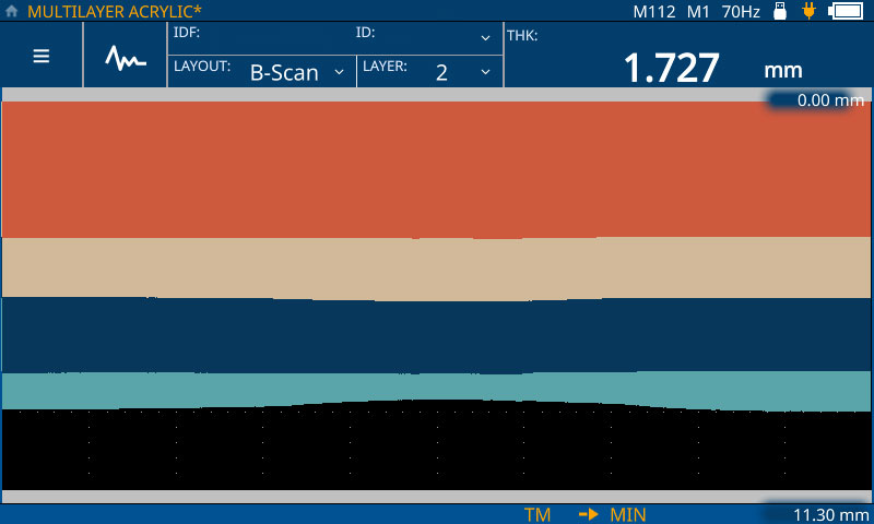 B扫描:超声B扫描