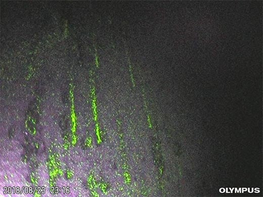 紫外线照射下的残留物