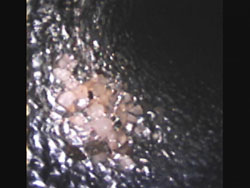 [Remnants of sand detected by videoscope inspection]