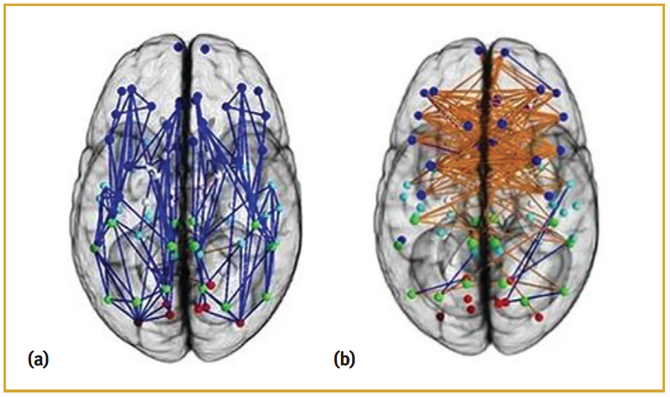 The male and female brains react differently. This is the point of gender diversity and women in STEM. This article also covers women in ndt and nde 4.0.