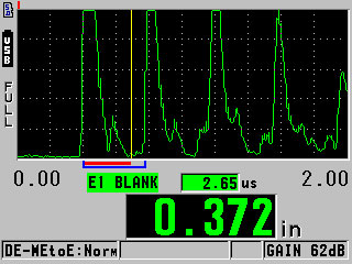 手动回波到回波