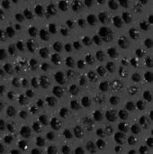 Evaluating New Methods of Dental Erosion Analysis