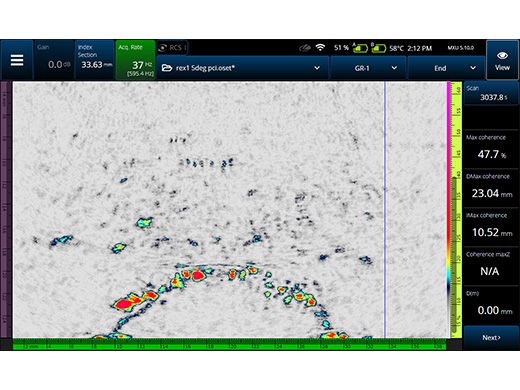 相位相干成像(PCI)