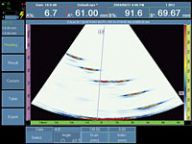 OmniScan扇形扫查